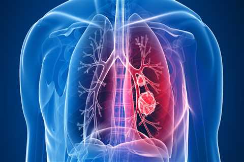 Does mesothelioma affect the heart?