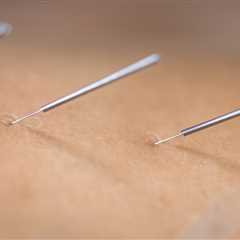 THE BENEFITS OF ACUPUNCTURE FOR CHRONIC PAIN IN THE ELDERLY