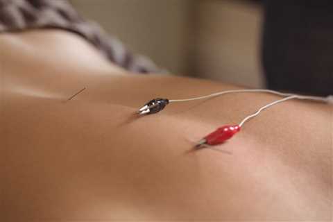 UNDERSTANDING THE LINK BETWEEN ACUPUNCTURE AND THE IMMUNE SYSTEM