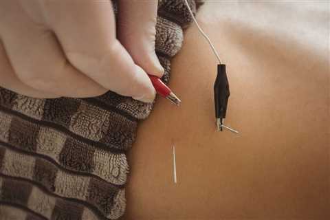 THE USE OF ELECTRO-ACUPUNCTURE IN PRACTICE