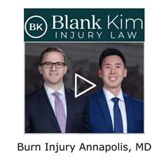 Burn Injury Annapolis, MD - Blank Kim Injury Law